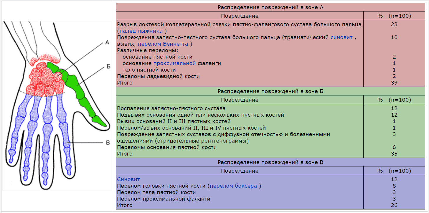 Ушиб кисти карта вызова