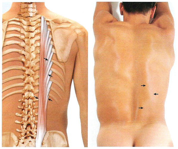 Musculi Intertransversarii mediales Lumborum